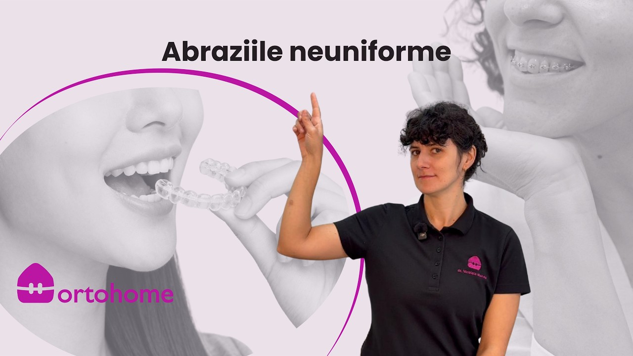 Abraziile neuniforme: cauze, semne și tratament | De ce se uzează dinții diferit