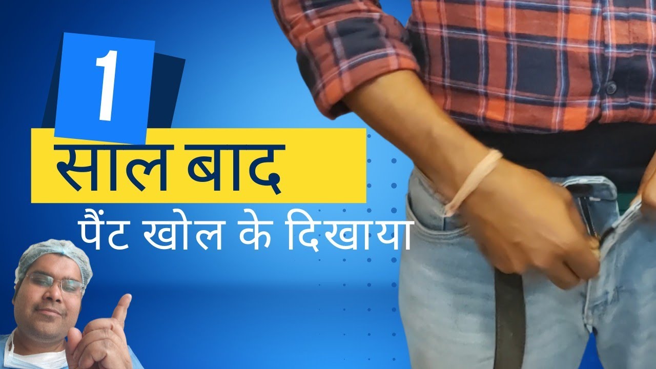 कपड़े में कैसे छुपेगा इम्प्लांट | Indian Penile Implant - 1 year Review