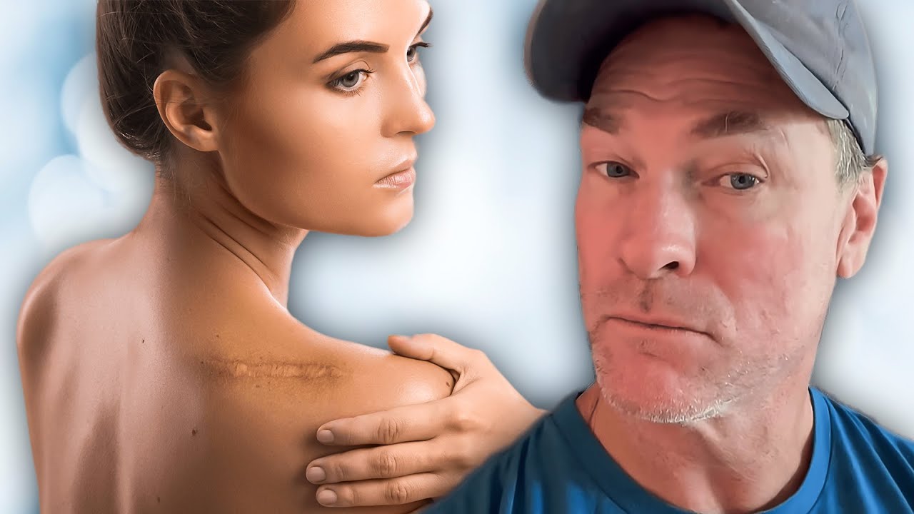 SUPER cure for Skin Damage? (You Won't Believe What It Is)