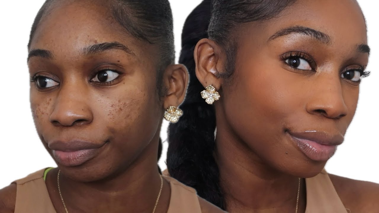 CLEAN GIRL MAKEUP FOR PITTED ACNE SCAR SKIN/TEXTURED SKIN/HYPERPIGMENTATION