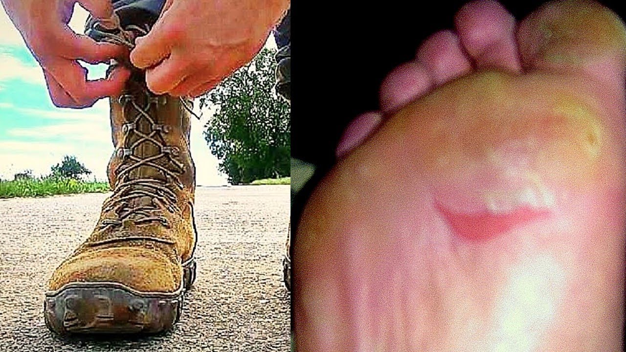 Уход за стопами от Rucking | Мозоли и боль