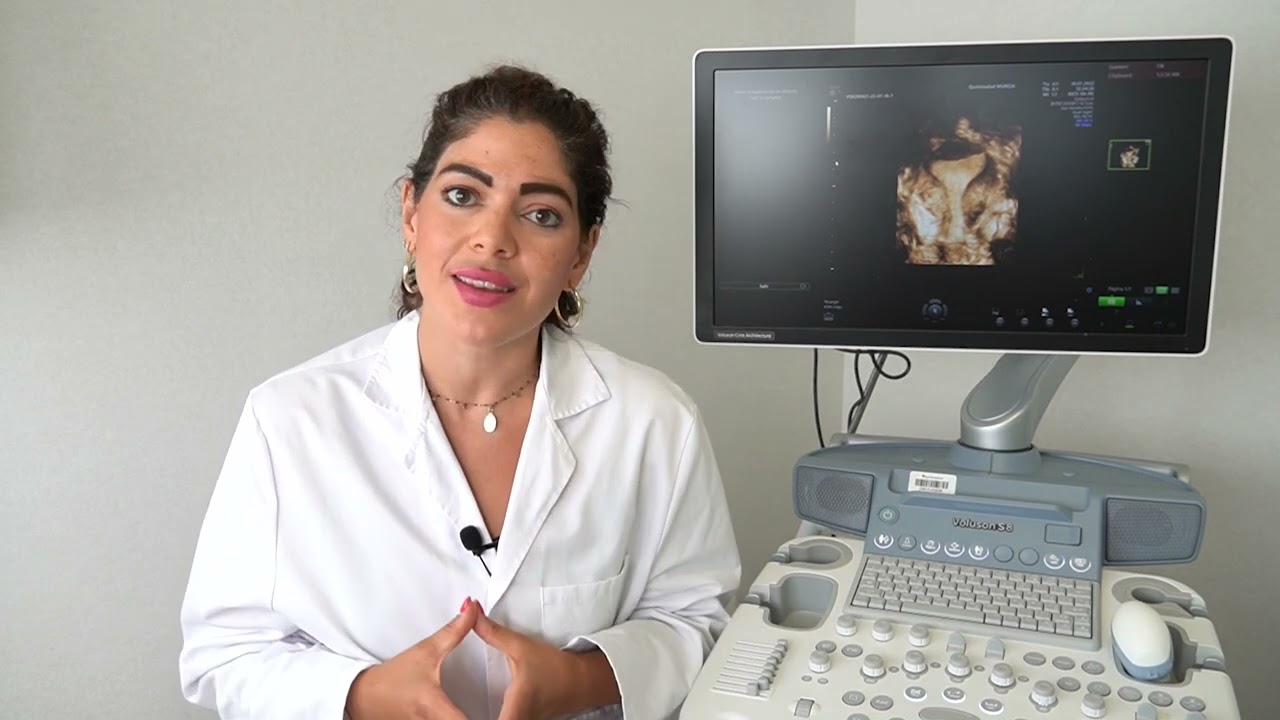 Malformaciones uterinas: Tipos de útero, consecuencias, pruebas y tratamientos