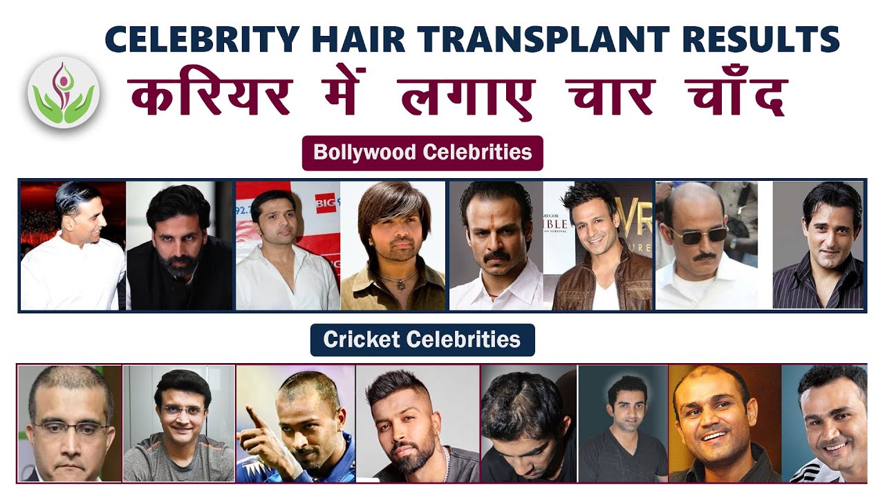 Top Bollywood Stars and Cricket Celebrities Who Underwent Hair Transplant | Care Well Medical Centre