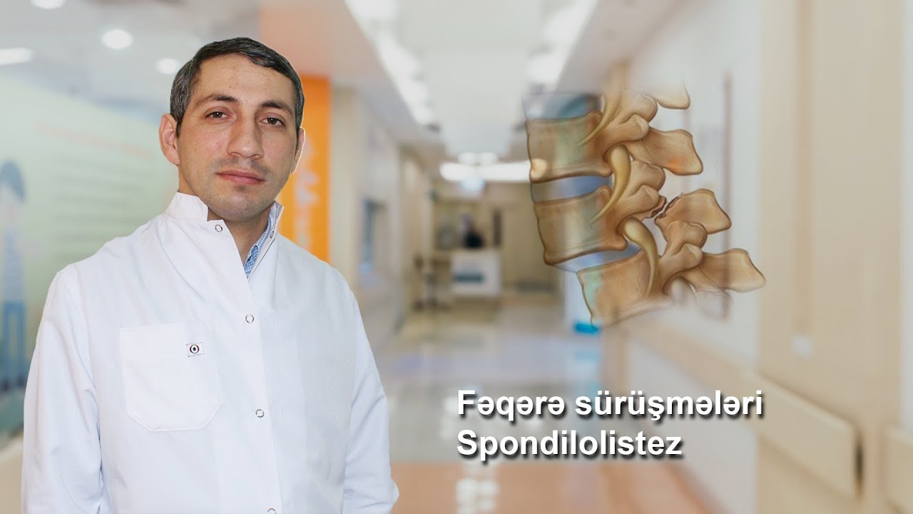 PhD Dr. Cəmil İskəndərov  İxtisas - Neyrocərrah Mövzu: Fəqərə sürüşmələri-spondilolistez