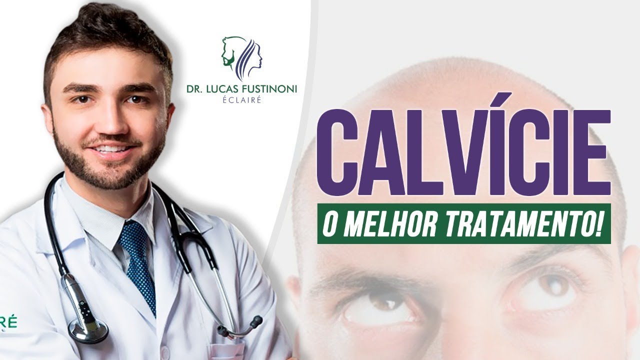 CALVICE e QUEDA DE CABELO: Qual o Melhor Tratamento? | Dr  Lucas Fustinoni