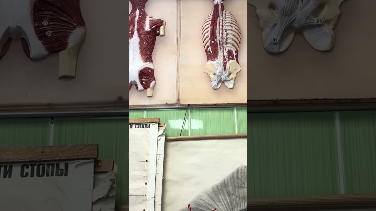 Muscles: of back part 1 