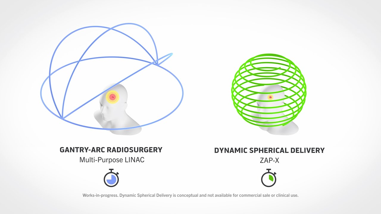ZAP Dynamic Spherical Delivery