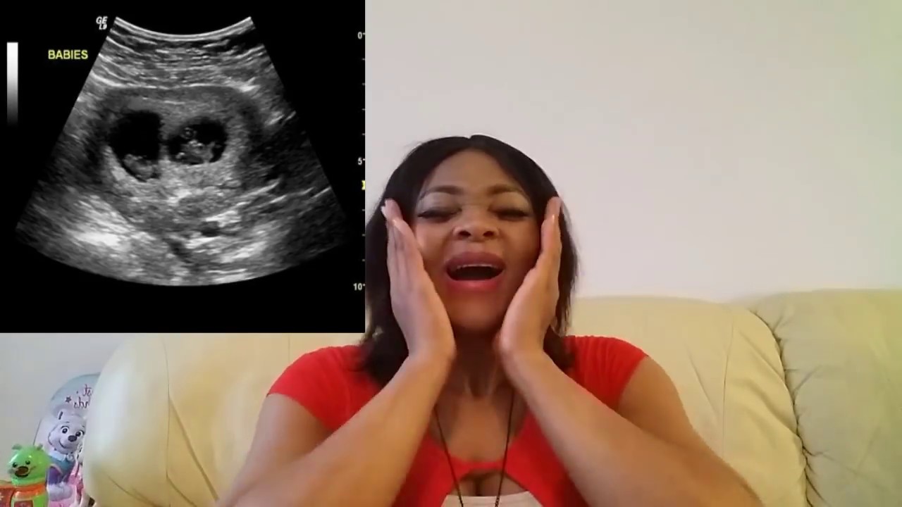 I GOT PREGNANT WITH TWINS NATURALLY/ Irisstace in Finland