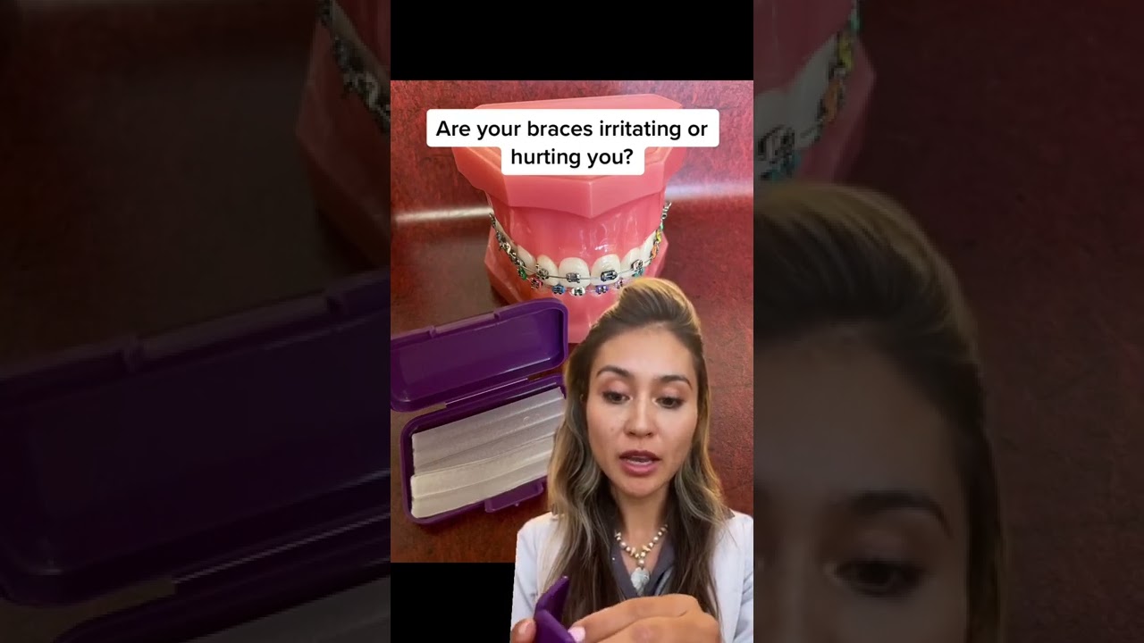 How to Use Wax on Braces