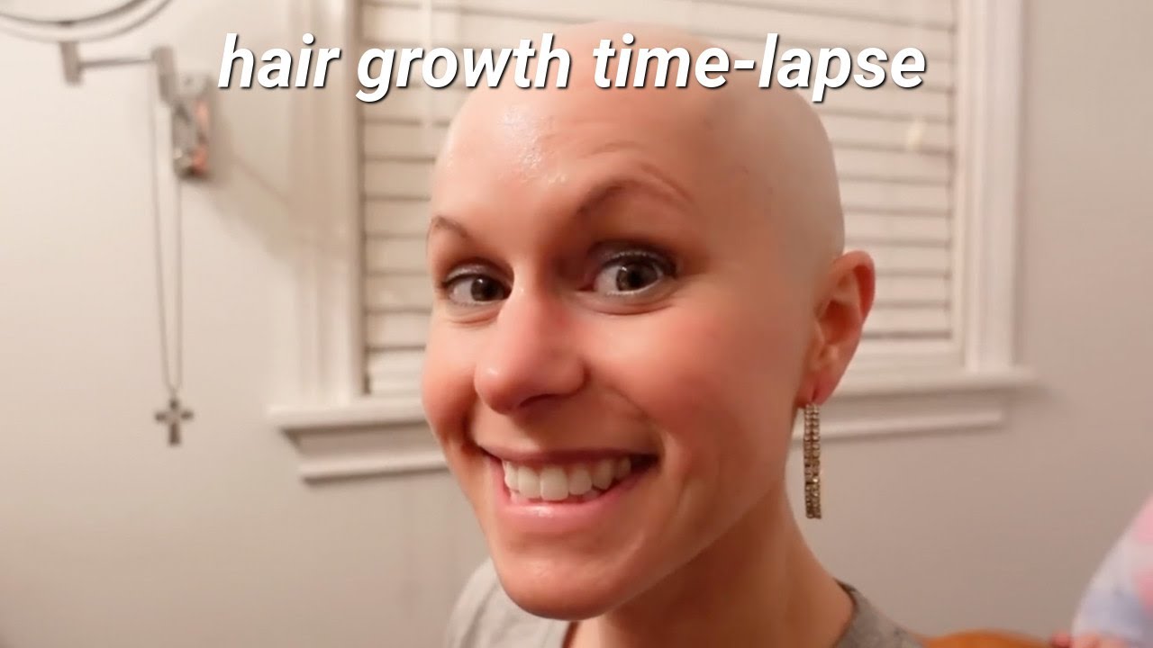 Completely BALD 1 Year Timelapse Hair Growth