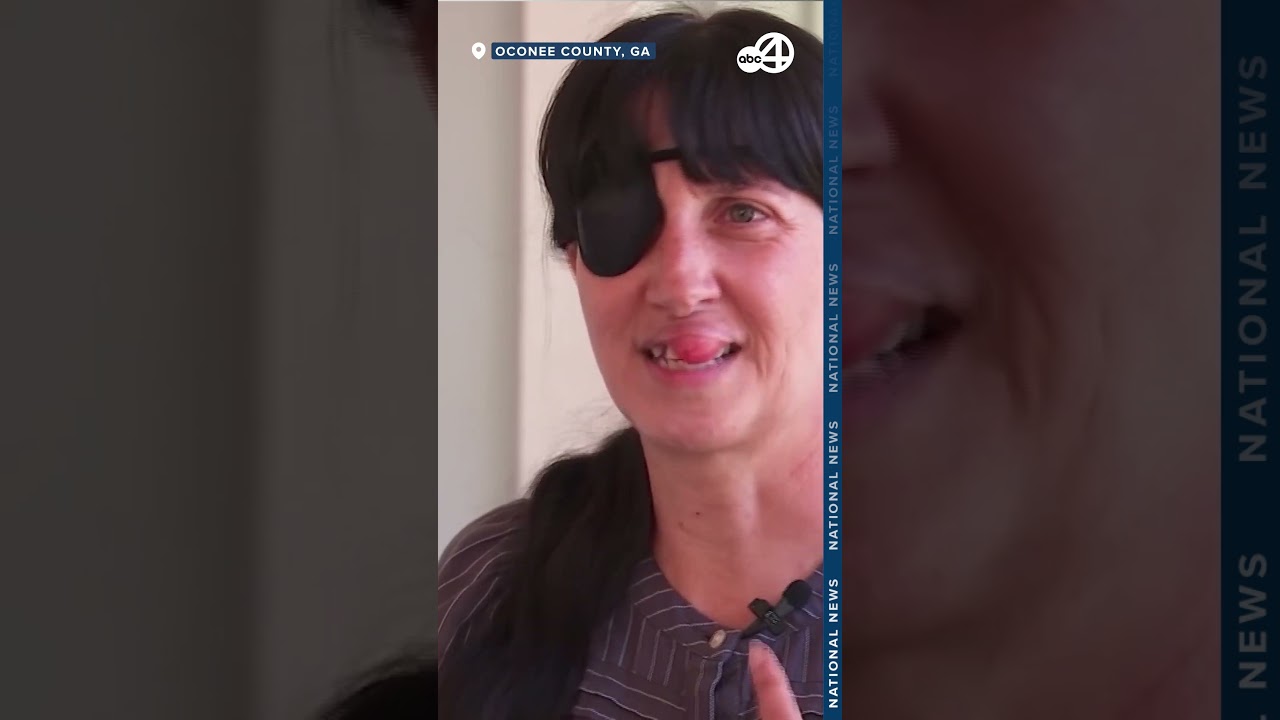 Woman bit by one of the most VENOMOUS spiders in the world