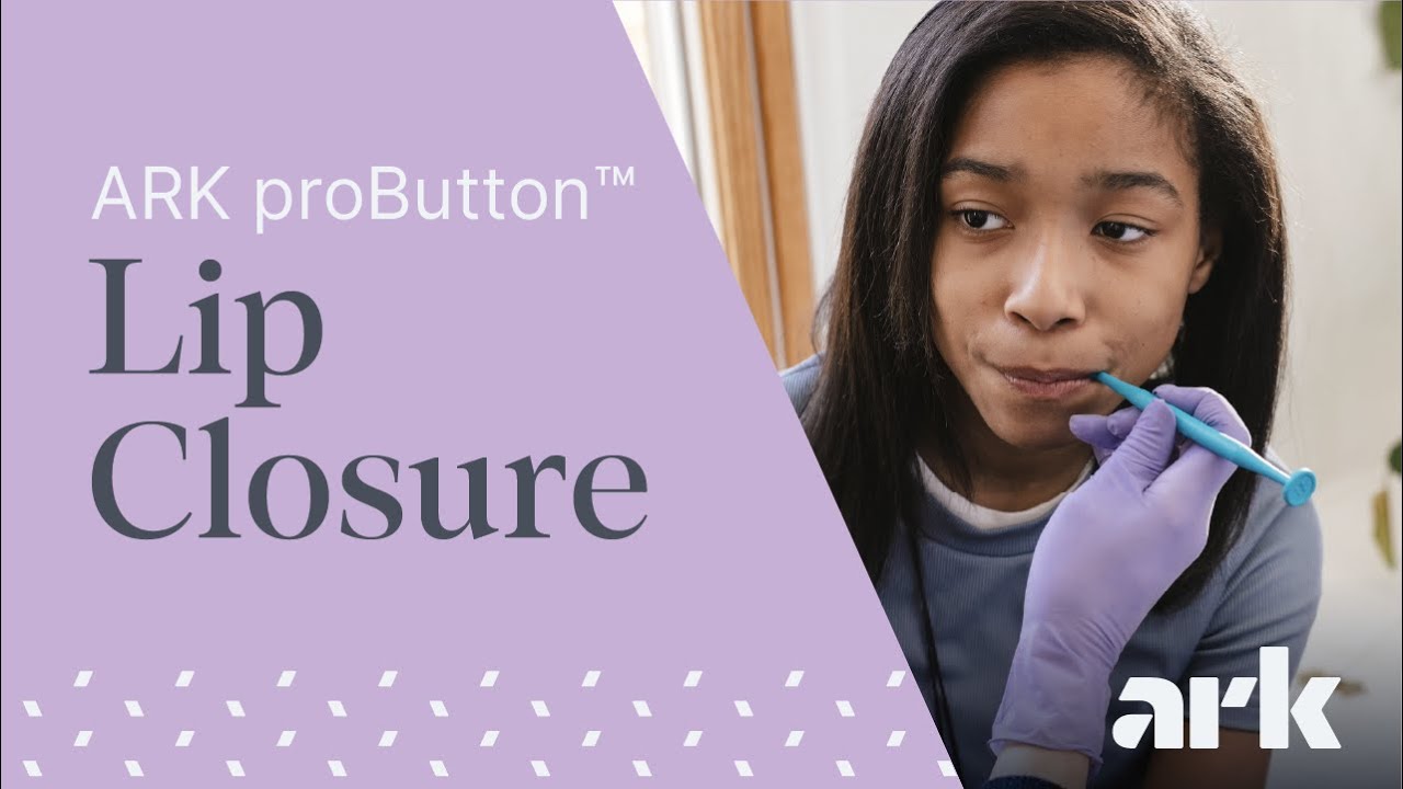 Упражнения на смыкание губ при нажатии кнопки с помощью proButton от ARK.