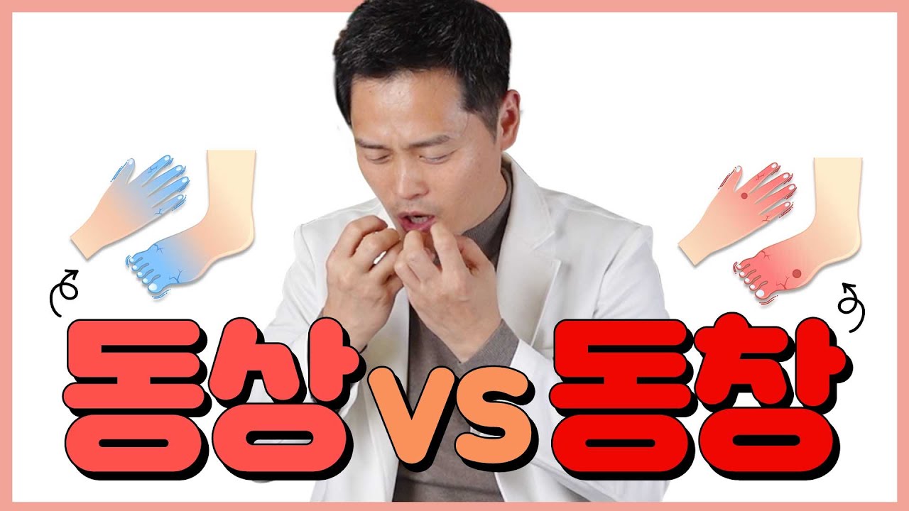 가볍게만 생각하면 안돼요! 동상, 동창에 걸렸다면 이렇게 하세요