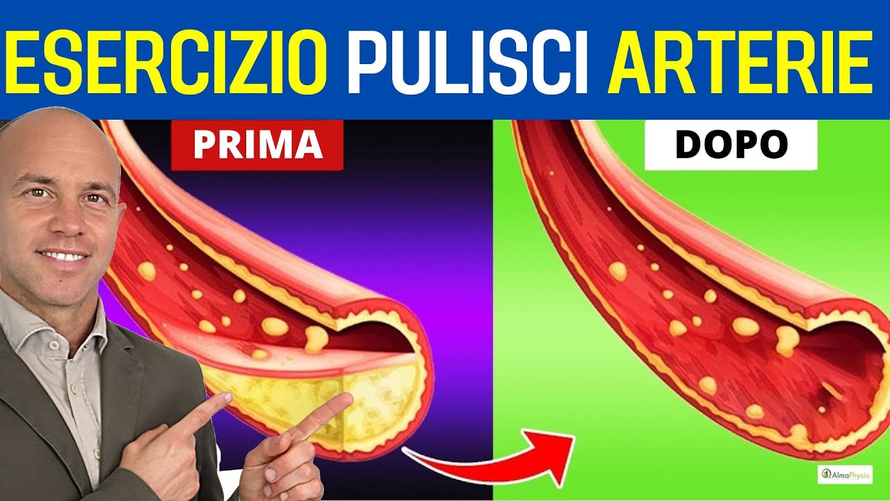 Questo esercizio riduce la PLACCA nelle arterie!  (Nuovo studio!)