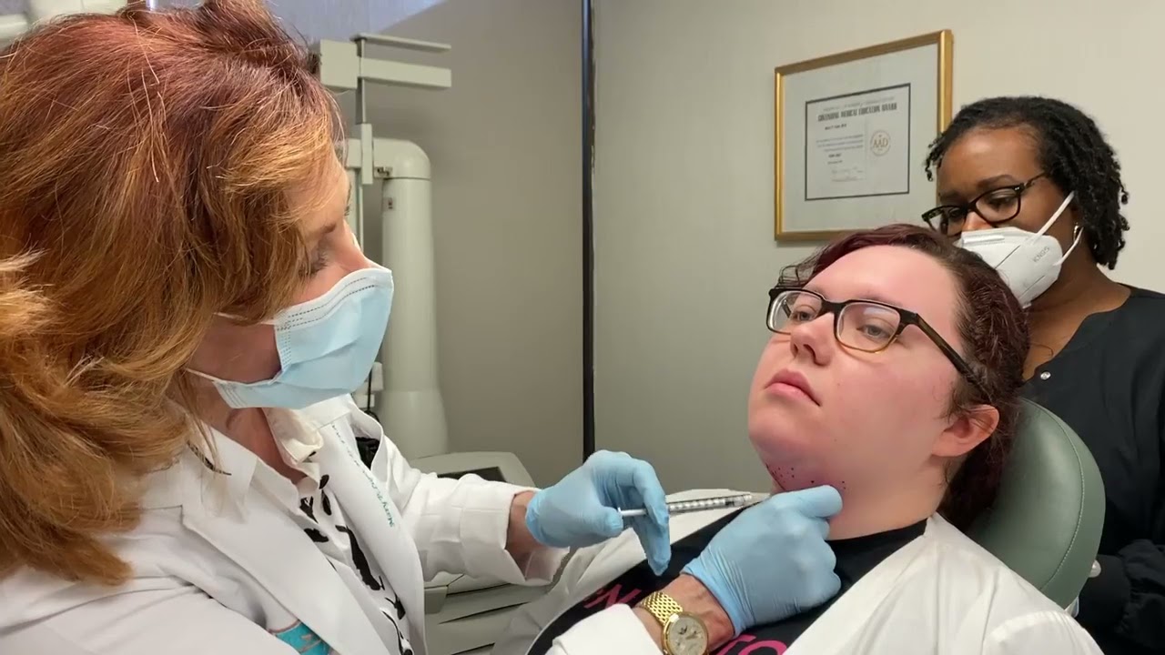 Kybella injectable for non-surgical double chin treatment