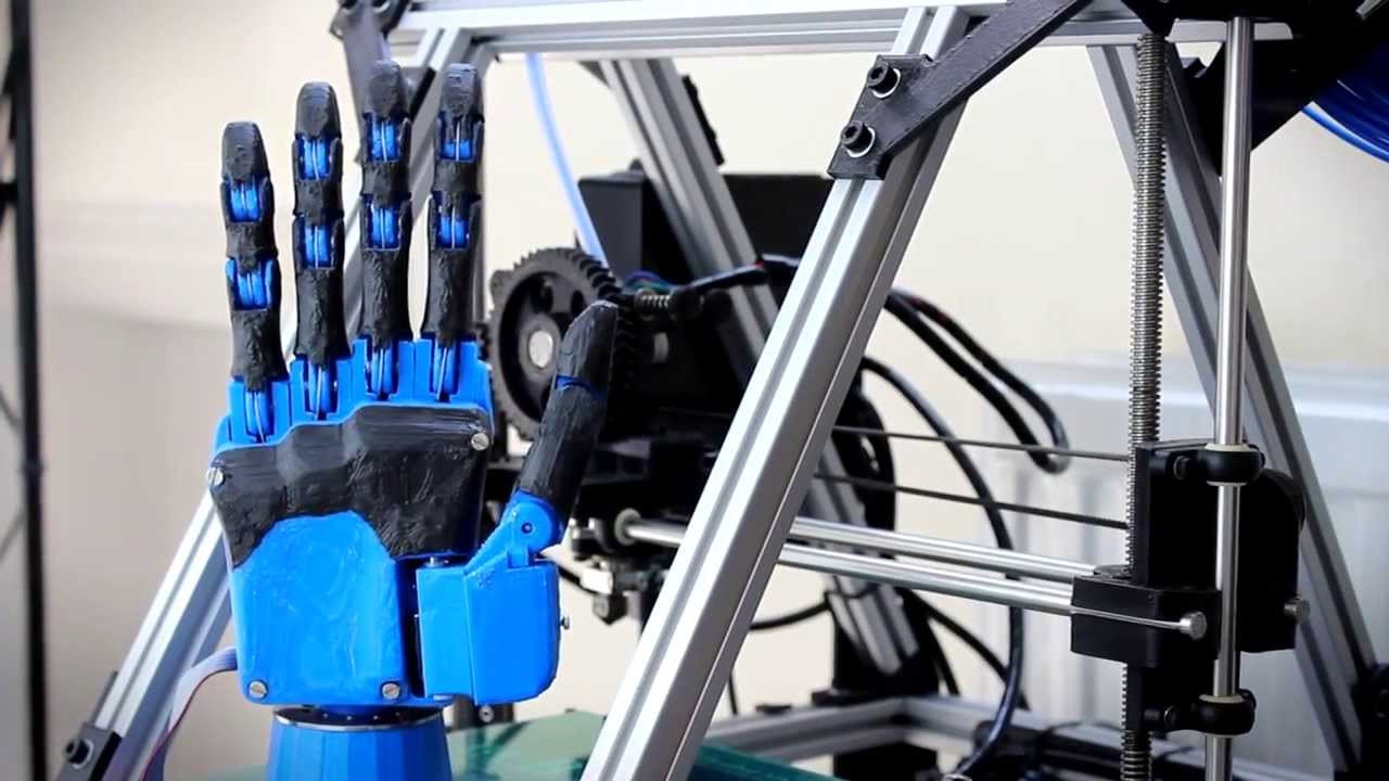 3D Printed Prosthetic Hand