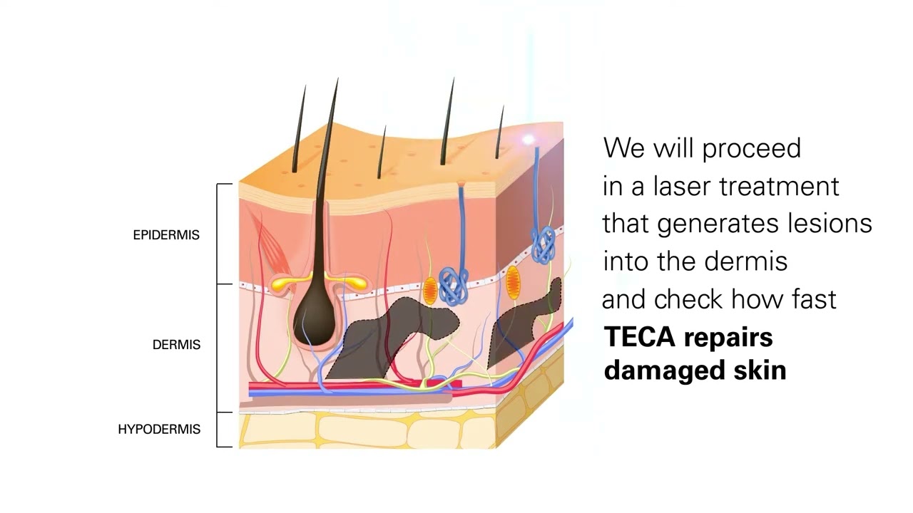 TECA