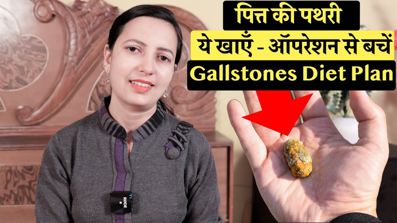 पित्त की पथरी में क्या खाना चाहिए l Gallstones Diet Plan l Gallstones Diet in Hindi