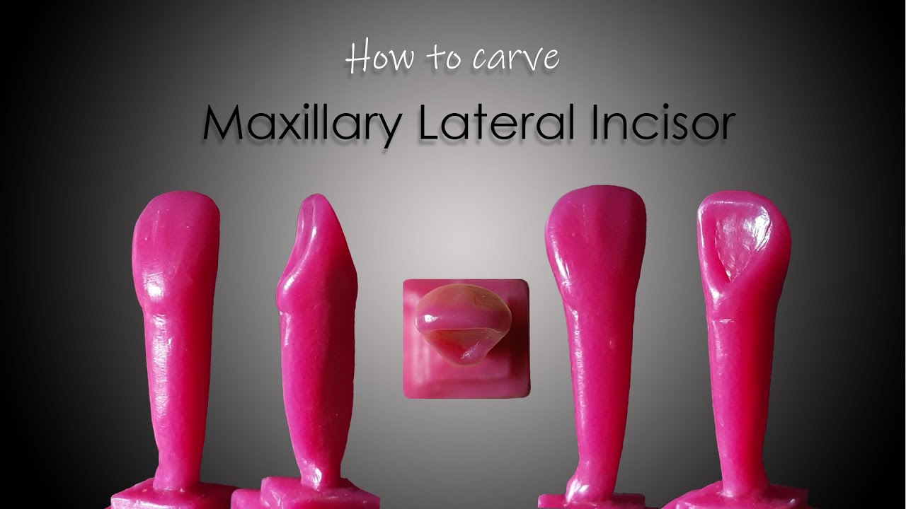 Как вырезать верхний боковой резец | ParixArt | Учебное пособие по резьбе | DADH