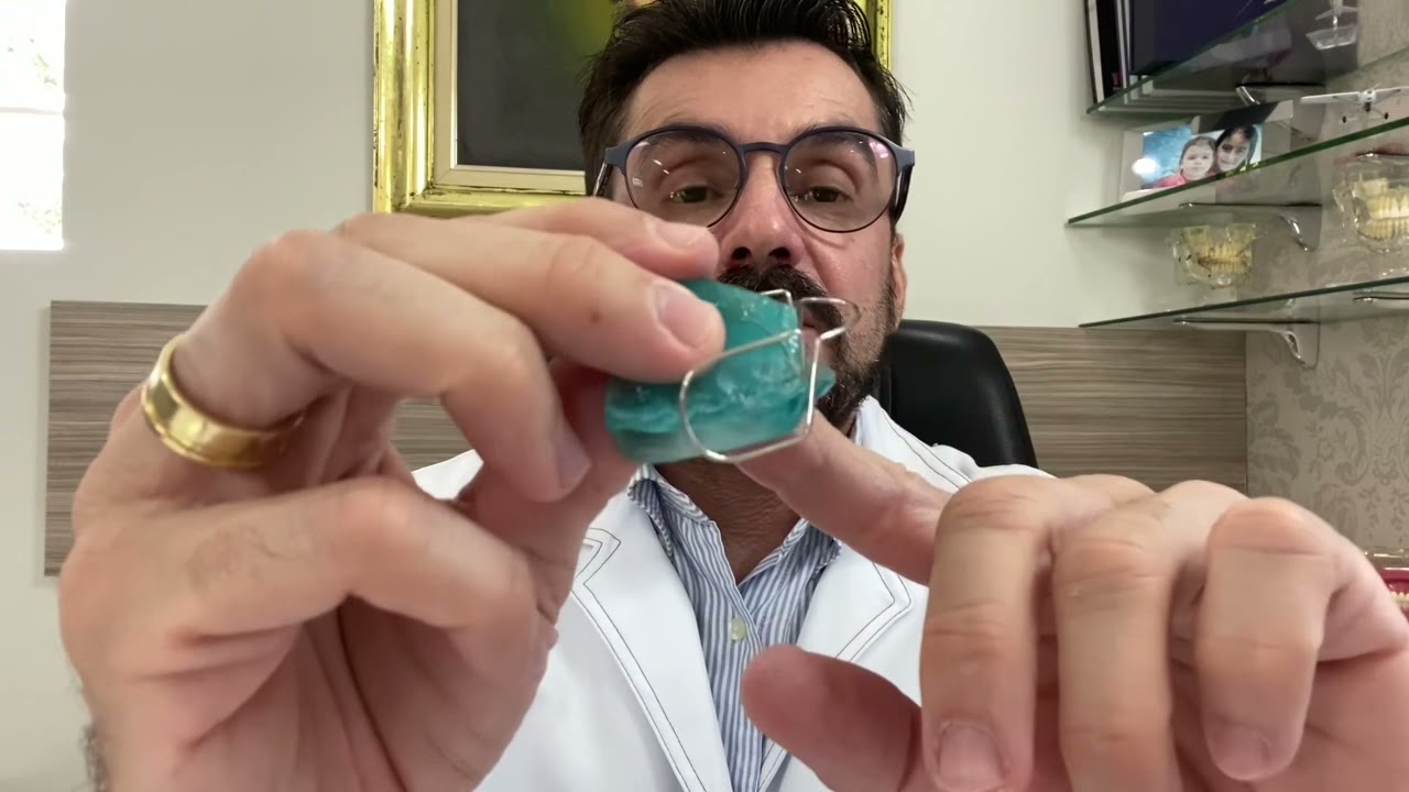 Bionator para tratamento da Classe II