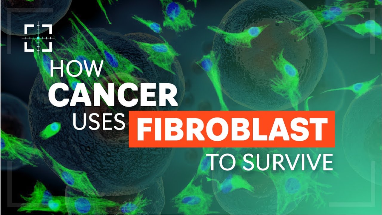 How Cancer Uses Fibroblast To Survive!