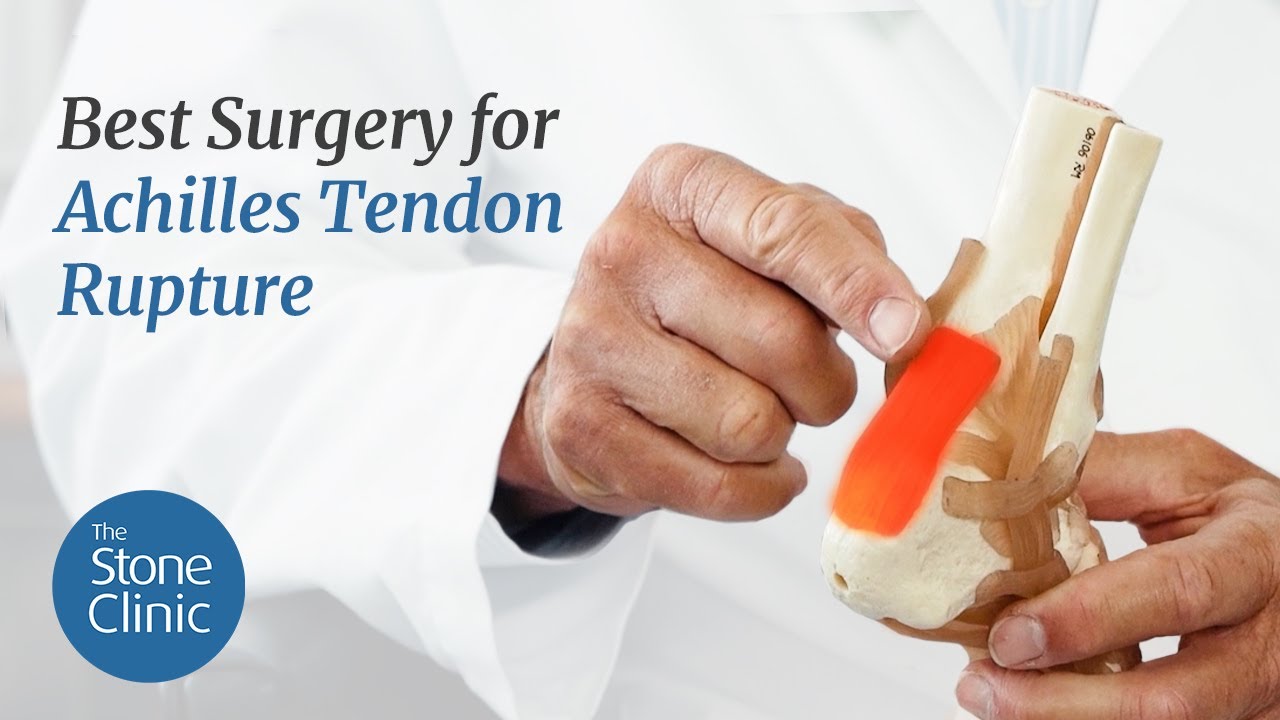 Best Surgery for Achilles Tendon Rupture - New Surgical Technique