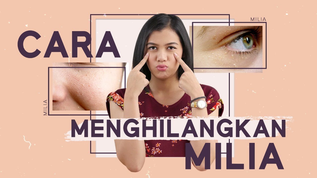 Begini Cara Menghilangkan Dan Mengatasi Milia Pada Wajah