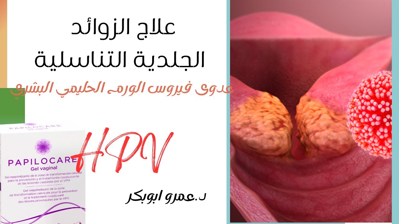 HPV علاج الزوائد التناسلية - مرض الورم الحليمي