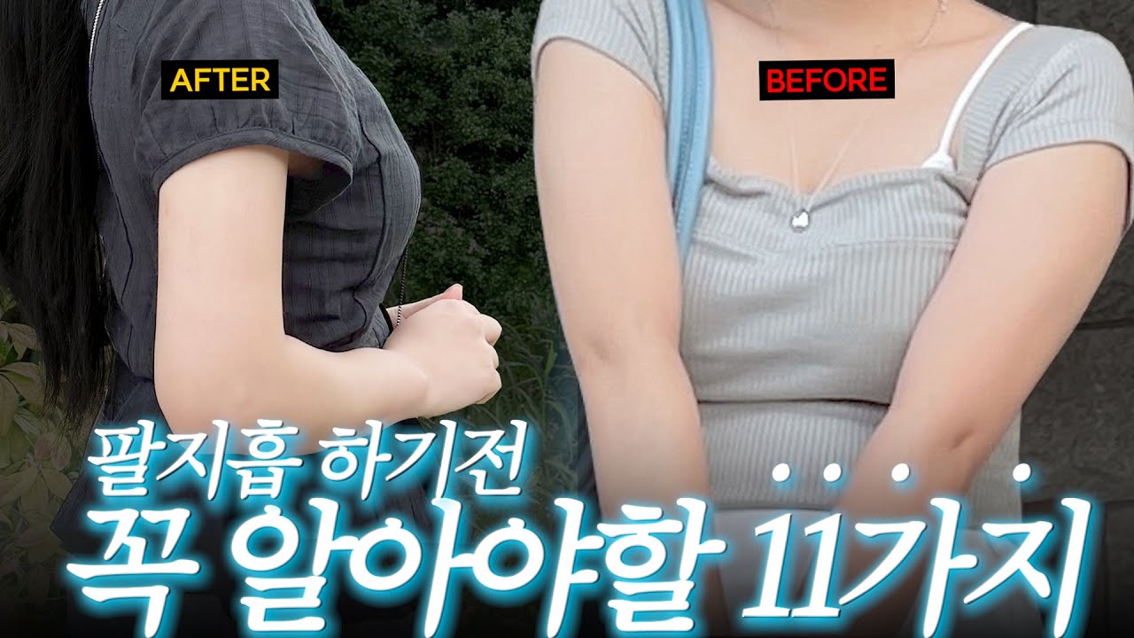 통증? 착색? 흉터? 홈케어? 팔지흡 Q&A | 팔지흡 해본자가 말아주는 현실 조언 11가지💥