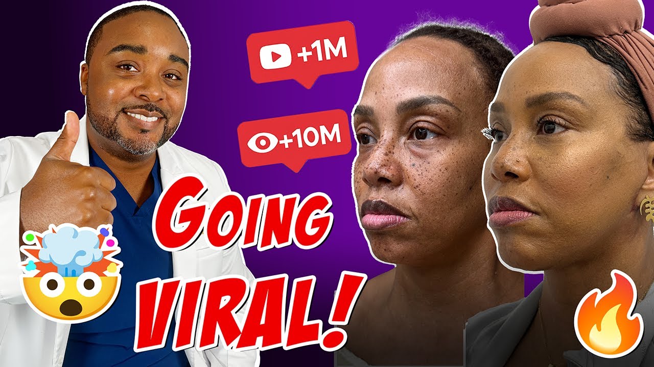How My Plastic Surgery Videos Went Viral (Over 10 Million Views!)
