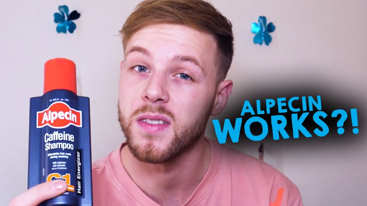 Does Alpecin caffeine shampoo reverse hairloss? The truth REVEALED