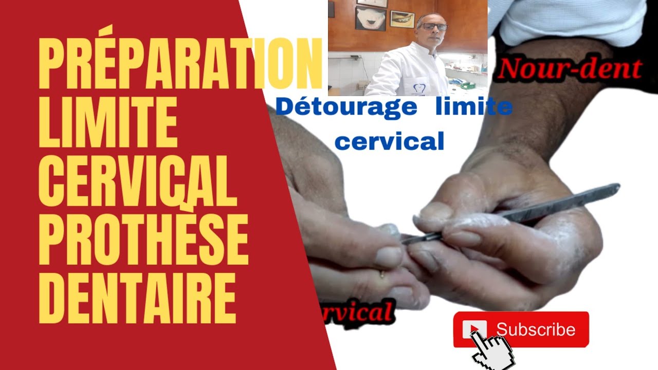 préparation du limite cervical prothèse dentaire. Détourage limite @NoureddineVlogsBr