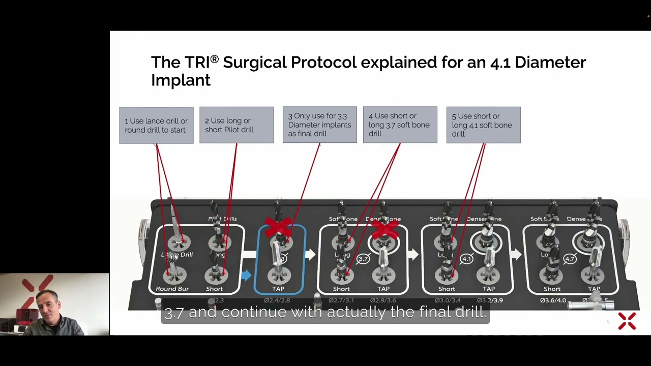 matrix&reg; Surgical Procedures | matrix&reg; Digital Academy