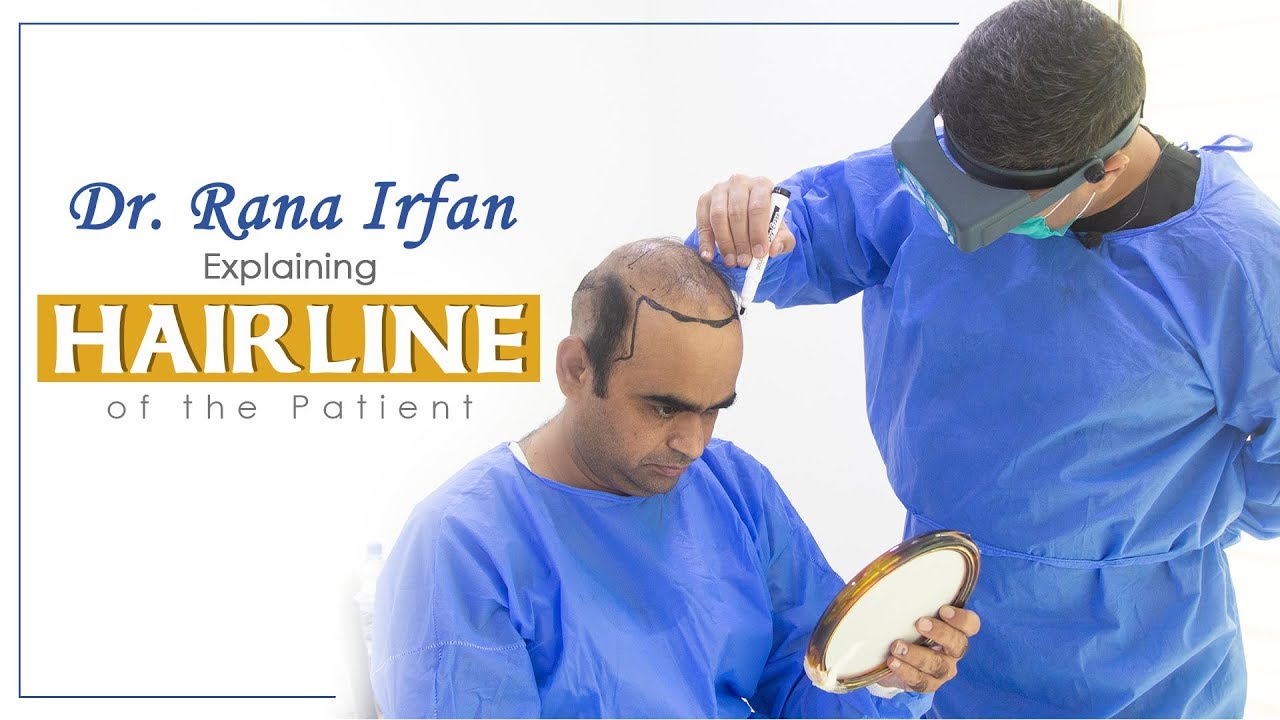 Explaining Hairline | How a Natural Hairline Is Created | What Makes a Hairline Look Natural