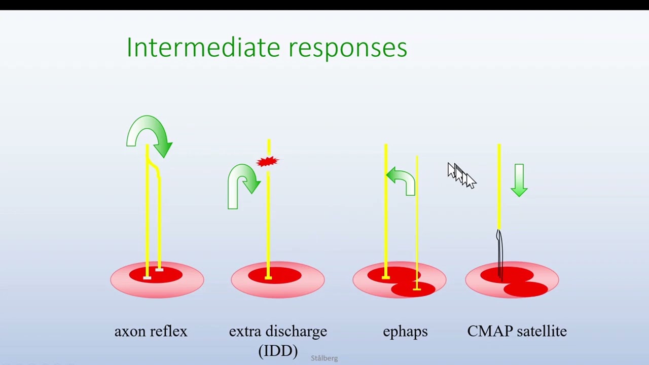 Intricate Signals in the EMG lab