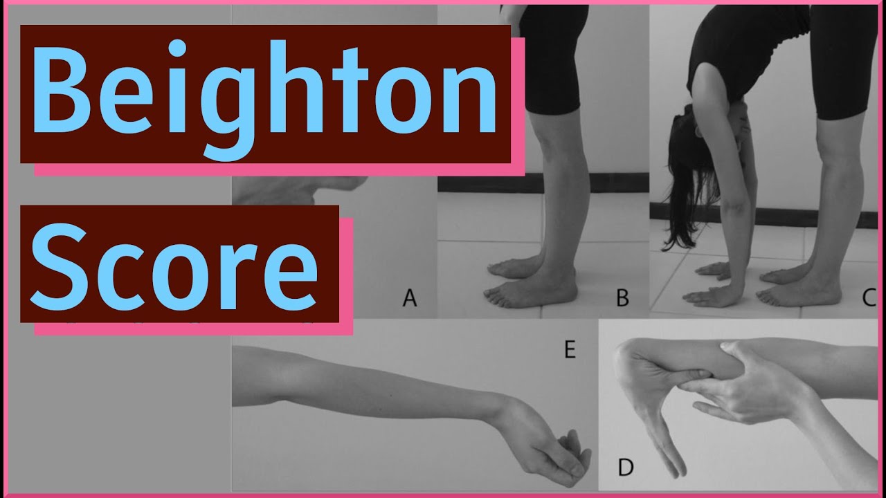 Beighton Score | Generalized Joint Hypermobility