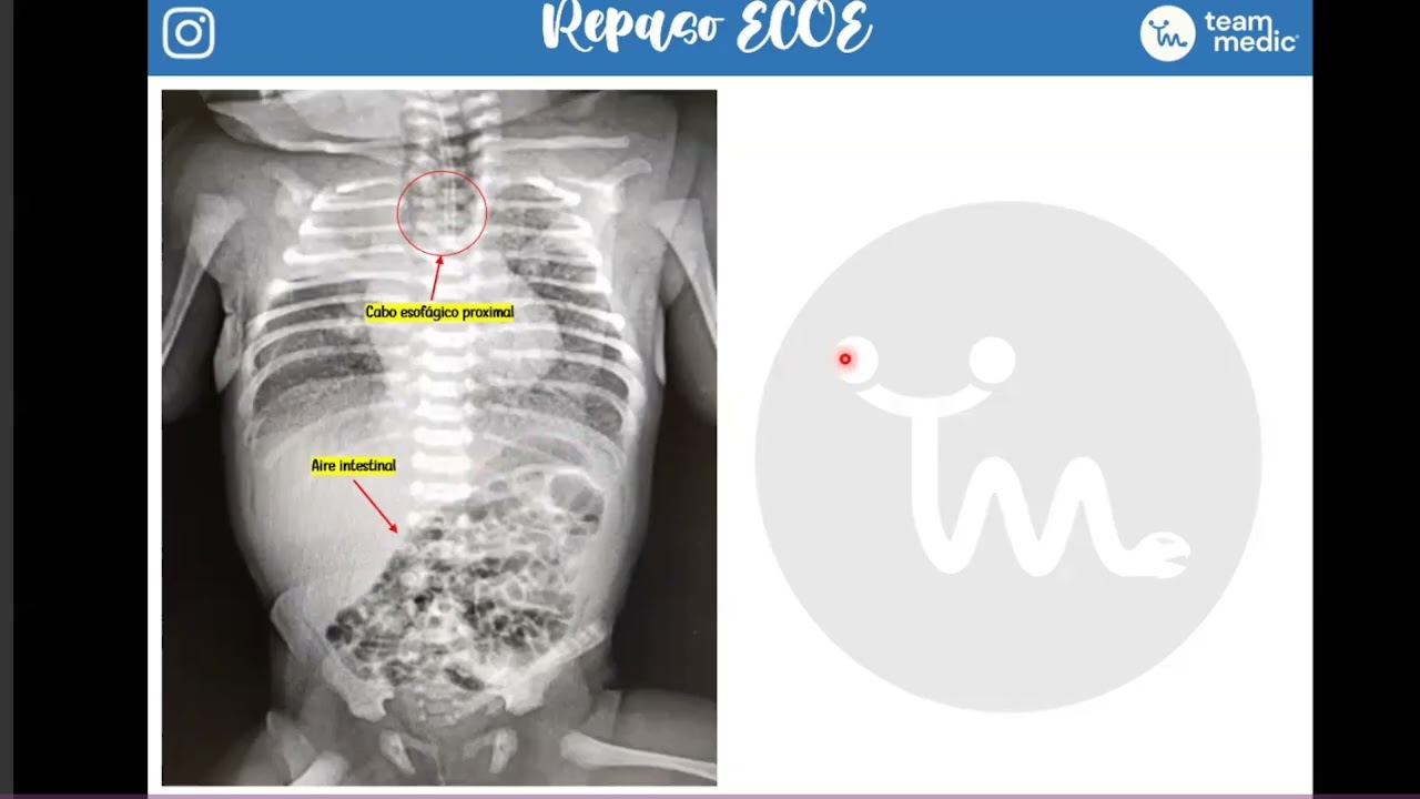ECOE PEDIATRIA 1