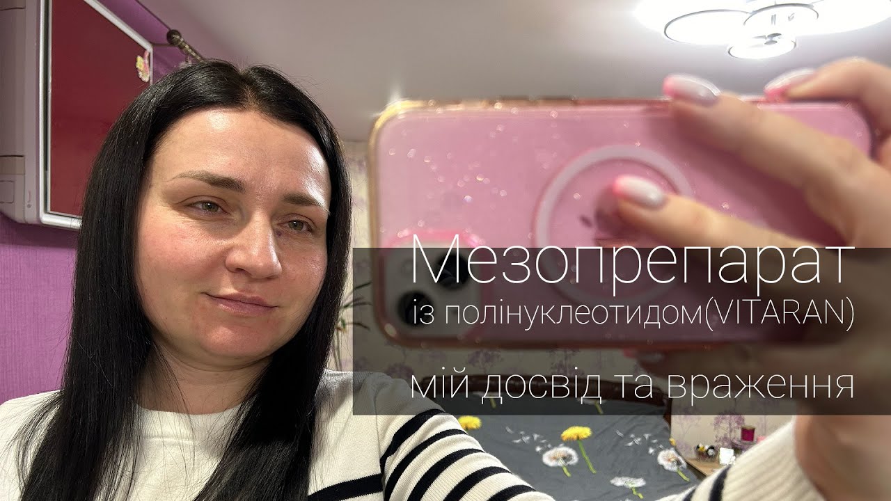 Мезопрепарат із полінуклеотидом (VITARAN). Мій досвід та враження