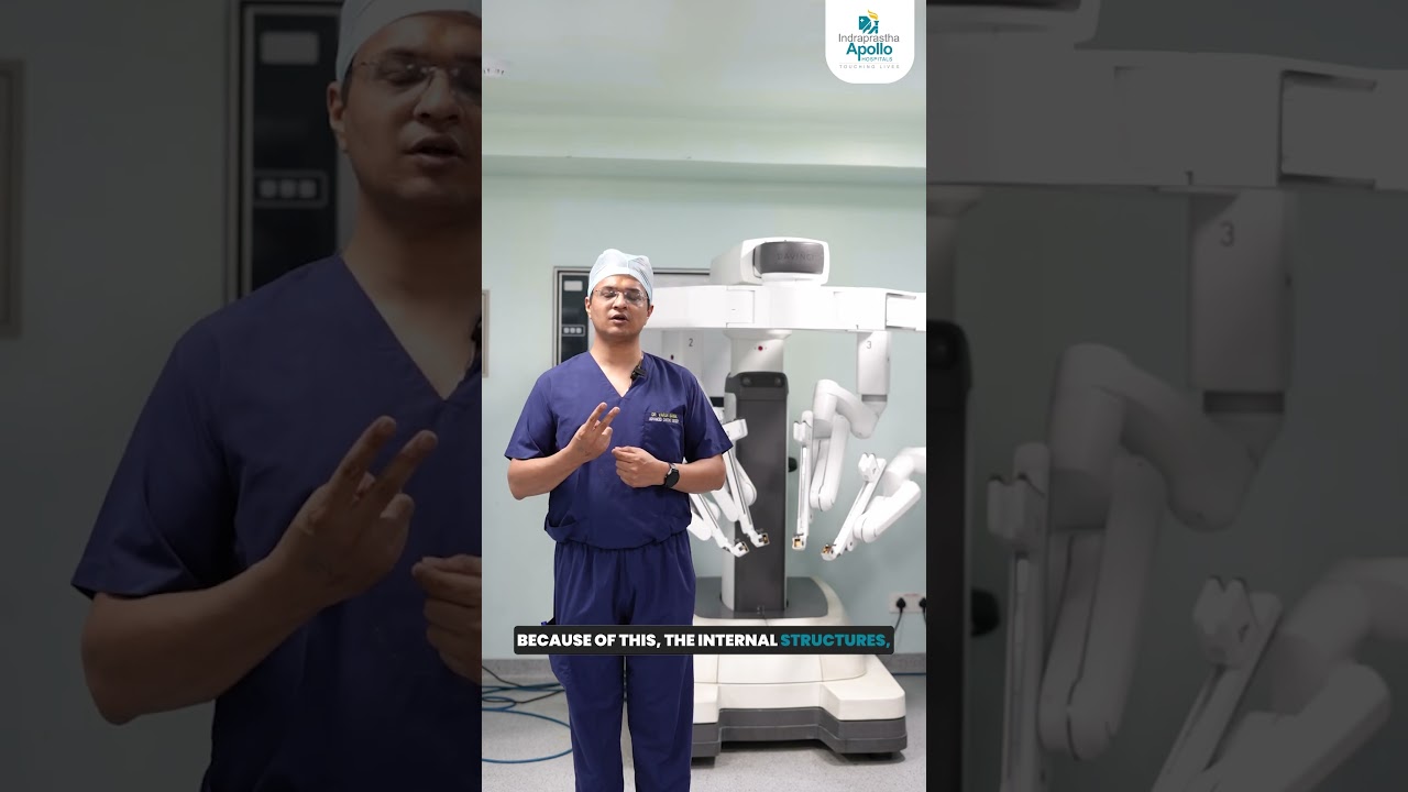 How Robotic Surgery Makes Heart Operations Safer | Apollo Hospital Delhi