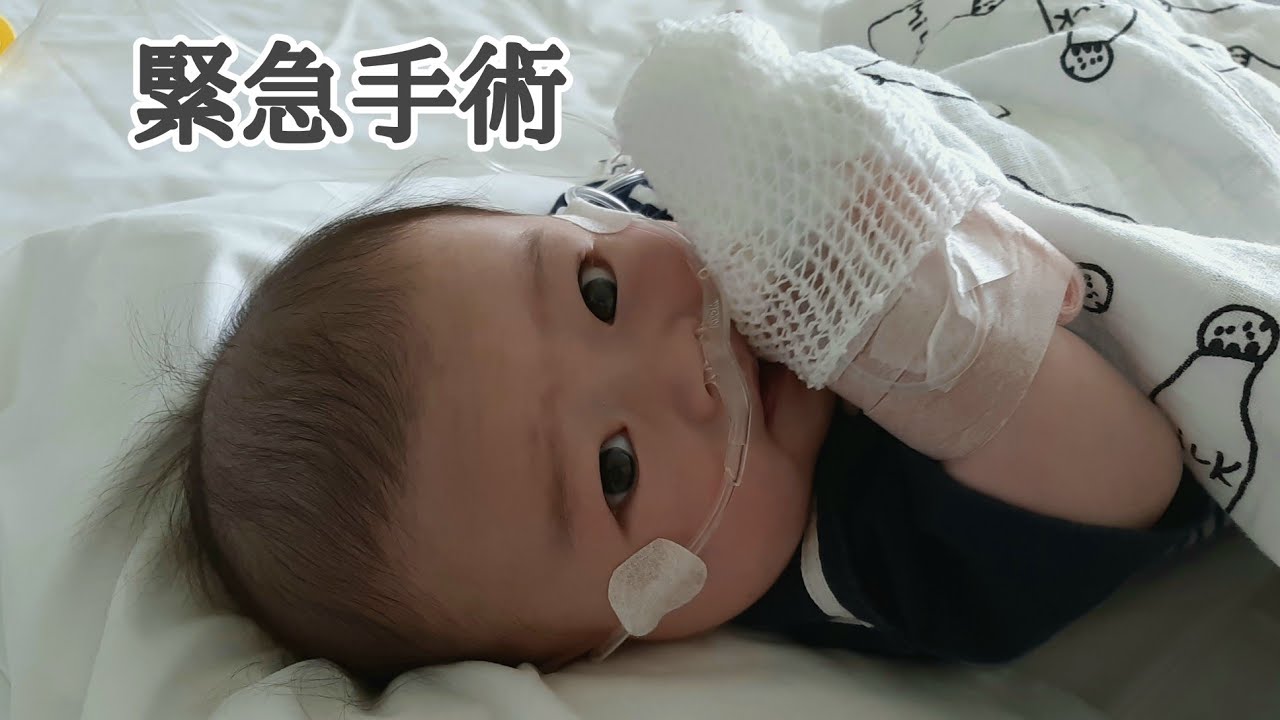 先天性心疾患/検査後から手術まで/グレン手術