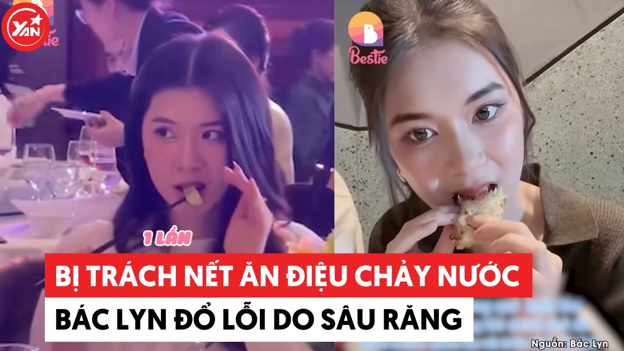 Bị trách nết “điệu chảy nước”, Bác Lyn đổ lỗi do sâu răng không hề muốn làm màu