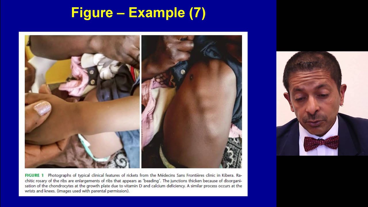 Module 3 - Day 2-5 - 2 - Tables and Figures