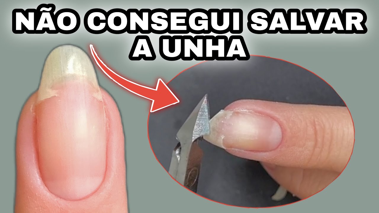 QUEBREI A UNHA DA PIOR MANEIRA E PRECISEI CORTAR