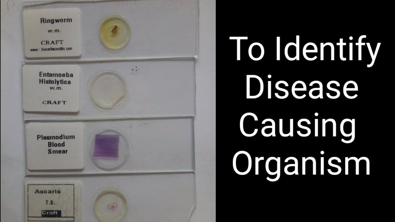 Identify Common Disease-Causing Organism 12th bio practical no -14 cbse, gseb