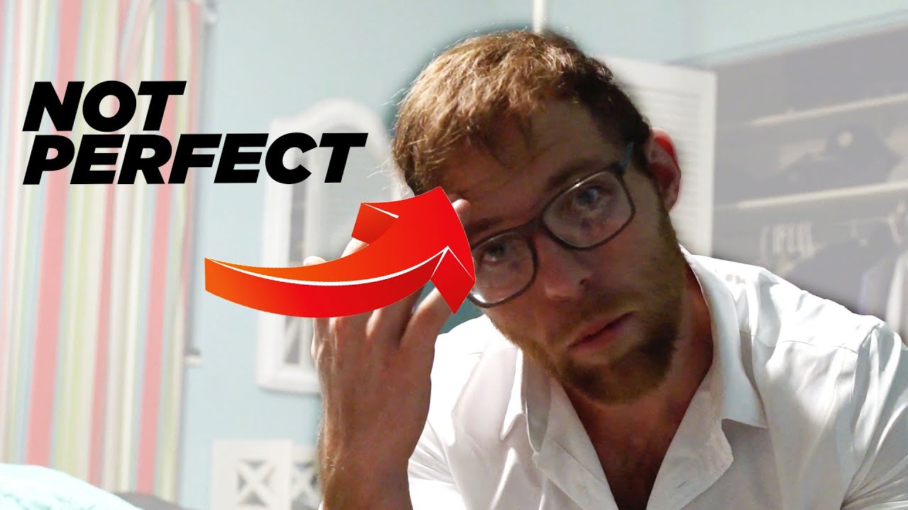 2 Reasons You Dont Need a Perfect Hairline