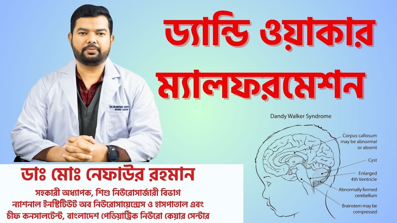 Dandy Walker Malformation: A paediatric neurosurgical disease. Paediatric Neurosurgeon Nafaur
