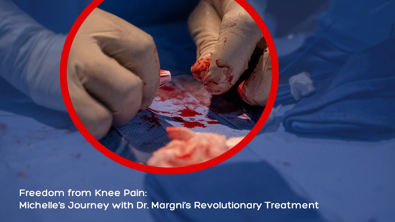 Freedom from Knee Pain: Michelle&rsquo;s Journey with Dr. Margni's Revolutionary Treatment