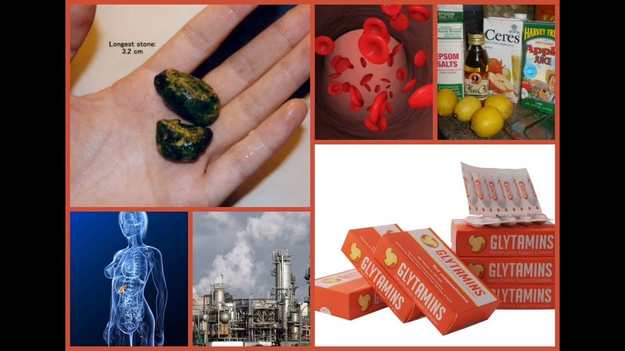 Liver Gallbladder Cleanse - Dissolve & Remove Gallstones without Gallbladder Surgery by Glytamins
