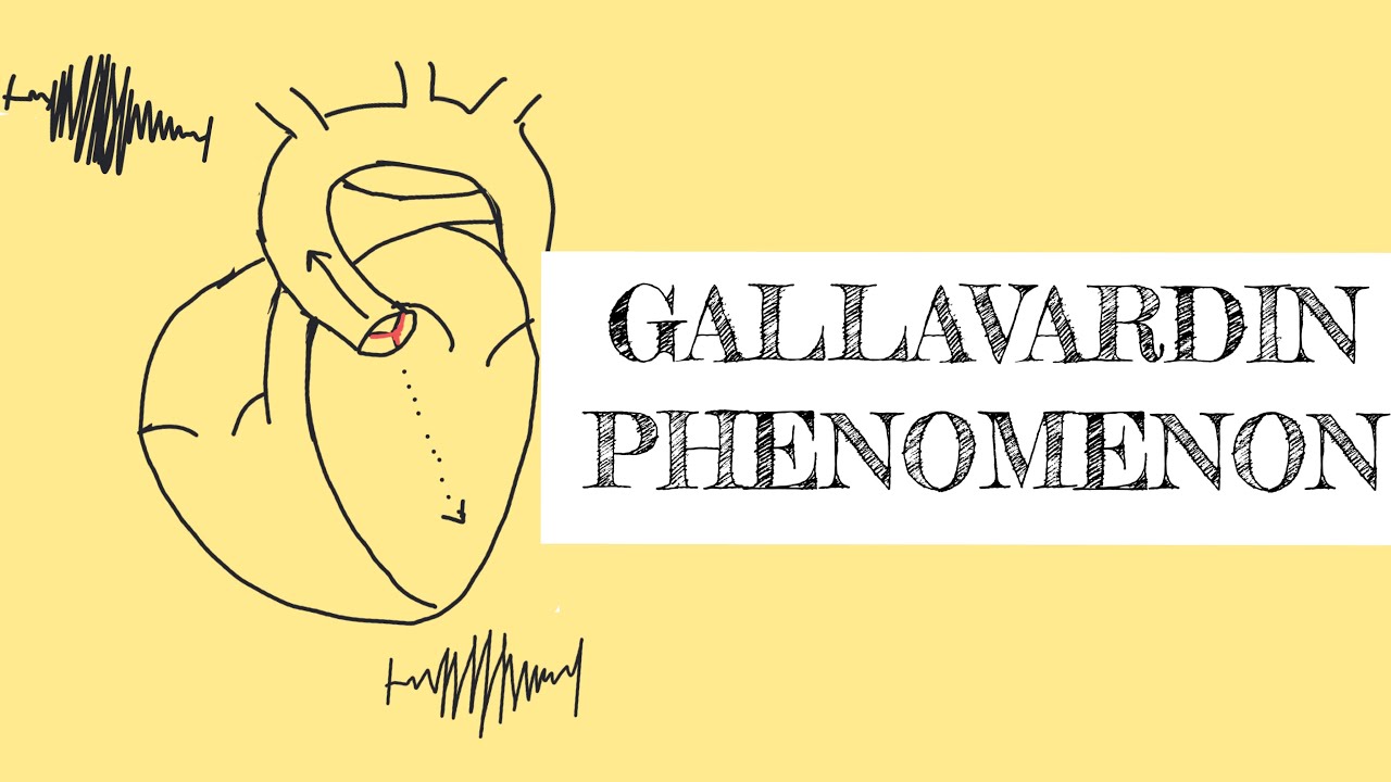 Gallavardin phenomenon