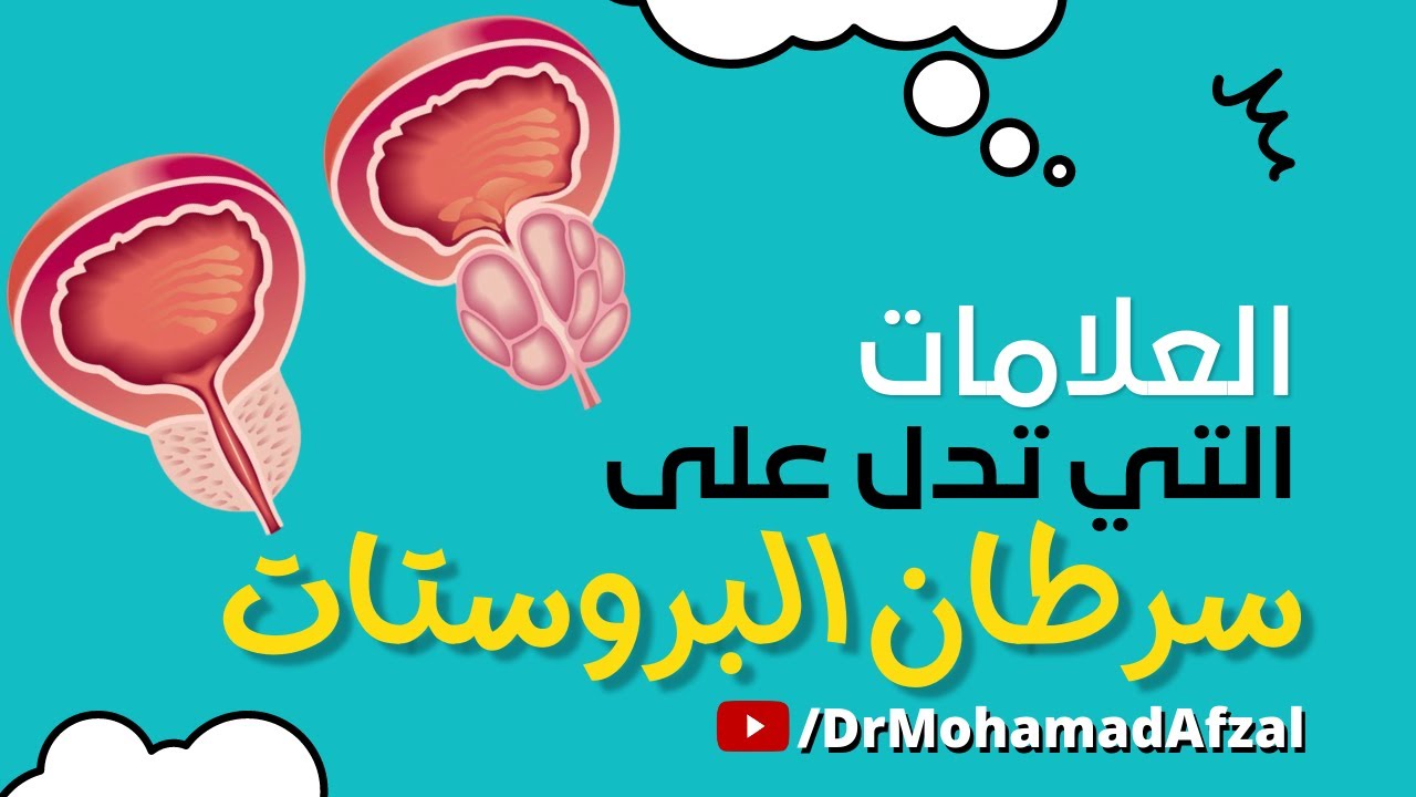العلامات التي تكشف عن سرطان البروستات؟